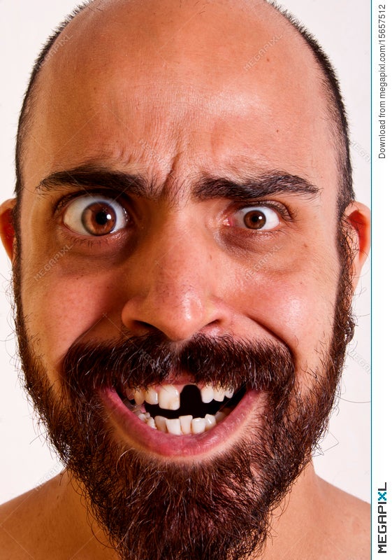Funny Man Without A Tooth Stock Photo 15657512 - Megapixl