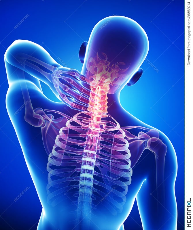 Anatomy Of Male Back And Neck Pain In Blue Illustration 26852014 Megapixl