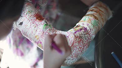 Children draw together on a plastered arm in a bandage. sister encourages and cares for a sick younger sister.
