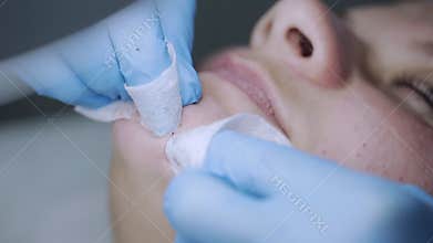 Cosmetologist removes acne on the face of the girl