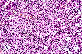 Microscope photo of a section through a rat liver, 60x zoom