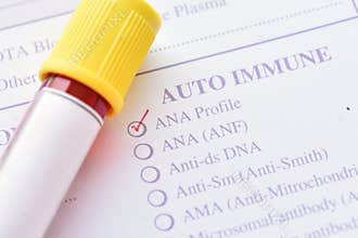 Antinuclear antibody test