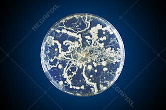 Bacteria growing in a petri dish