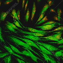 Fibroblast cells mebrane labeled with fluorescent dyes