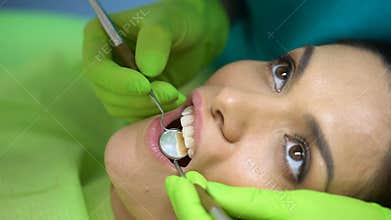 Sealant placement on central incisor, cosmetic dentistry for chipped tooth
