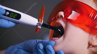 Dentistry, medicine. Dentist puts protective glasses on babys face and working with the dental curing light