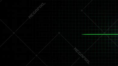 Cardiac arrest on the cardiogram monitor