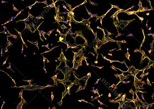 Real fluorescence microscopic view of human fibroblasts