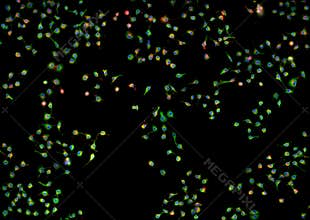 Real fluorescence microscopic view of cancer cells