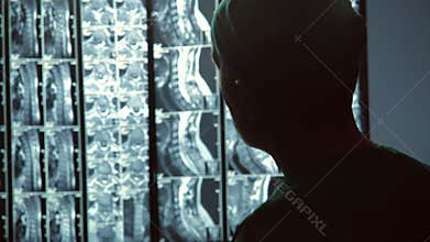 Attentive doctor focused on patients spine MRI scan, diagnostics expert at work