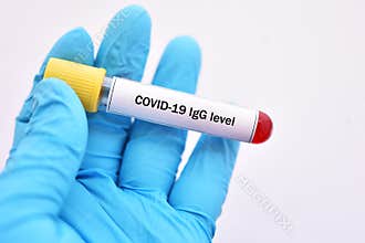 Blood sample for COVID-19 antibody level test