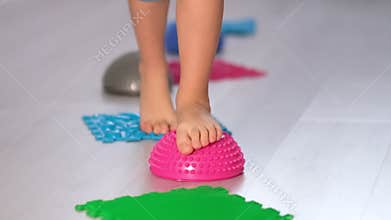 Flat feet physical therapy. child with a flat-bottomed stomach goes barefoot on an orthopedic foot mat for the