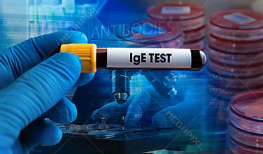 Doctor holding Blood sample tube for Immunoglobulin E antibody or IgE level test in blood for diagnosis allergic diseases