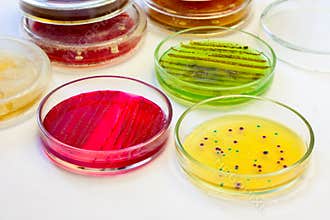 Petri dishes with bacterial colonies