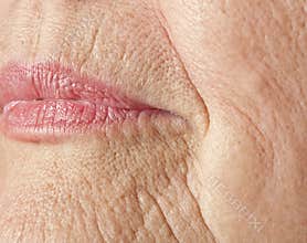 Wrinkled woman skin