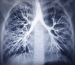 Bronchoscopy image. Chest X-ray. Healthy lungs