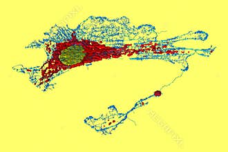 Fibroblast cell