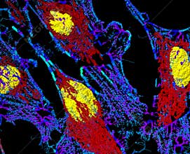 Fibroblast cells