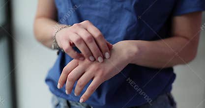 Woman scratches skin of hands at site of irritation and itching