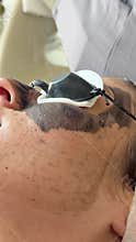 Young woman getting carbon laser facial at beauty clinic. Professional skincare