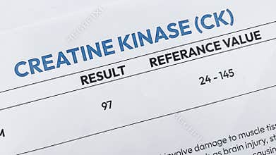 Close up of a Medical Lab Report Showing Creatine Kinase Result for Muscle Health Diagnostic and Clinical Blood