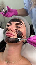 Young woman getting carbon laser facial at beauty clinic. Professional skincare