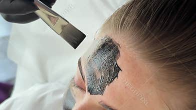 Young woman getting carbon laser facial at beauty clinic. Professional skincare