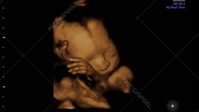 Baby Girl showing her fine Feminine Hands and Fingers. Footage of a Ultrasound 3d & 4d Gestation Scan