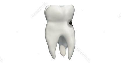 Tooth with caries, 3d animation. 3D rendering