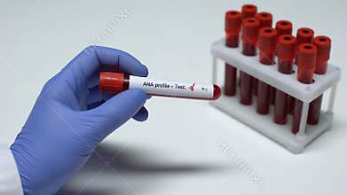 Negative ANA profile test, doctor showing blood sample in tube, health checkup