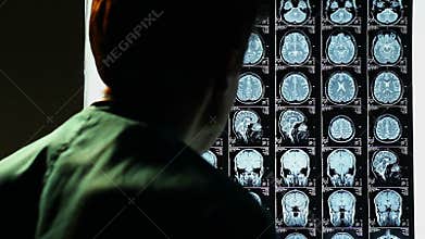Head MRI, surgeon observing skull brain x-ray film, analysis