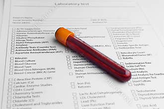 Form to fill in with results of blood test in tube
