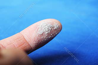 Dust and finger