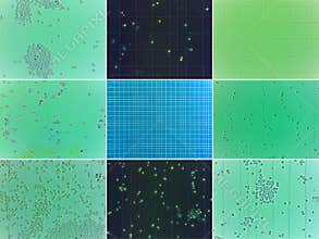 Microscopic yeast collage