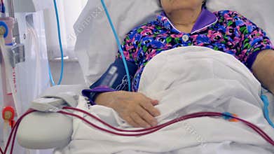 A dialysis machine connected by tubes to an elderly womans arm.