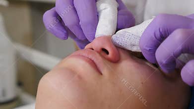 Beautician making face mechanical cleaning. Cosmetologist squeeze acne on facial skin nose with fingers. Skin care