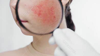 A beautician in white gloves shows redness on a woman's cheek through a magnifying glass. Close up. The concept of