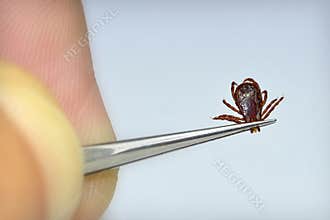 Dog Tick Removal
