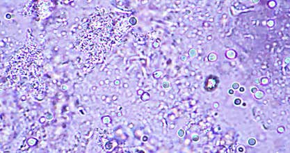 virus and bacteria infection, looking at it under the microscope, with cells and microorganisms. Bacteria and cells close up,