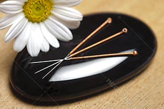 Acupuncture