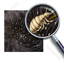 Lice Problem