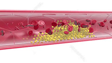 Anatomical 3D animation of the interior of an artery with the movement of red blood cells.