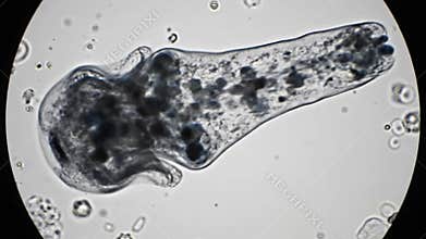 Slowmoving Freshwater Polyp With Internal Cellular Structure Observed Microscopically. Microscopic Examination Of