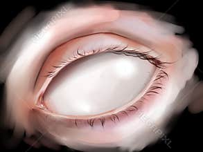 Blind eye