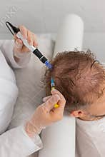 Trichologist doing man improve hair growth procedure, dermapen microneedling, vitamin injections