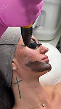Young woman getting carbon laser facial at beauty clinic. Professional skincare