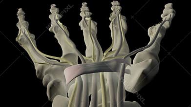 Carpal tunnel syndrome