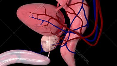 Benign prostatic hyperplasia overview