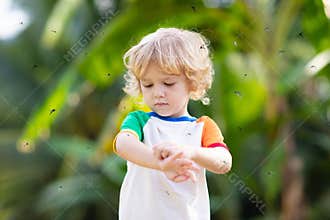 Mosquito on kids skin. Insect bite repellent
