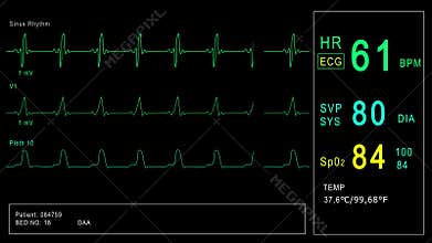 Looped: Patient monitor displays vital signs ECG electrocardiogram EKG, oxygen saturation SPO2 and respiration. Medical